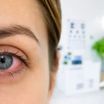 Types of Conjunctivitis: Viral, Bacterial, and Allergic Explained